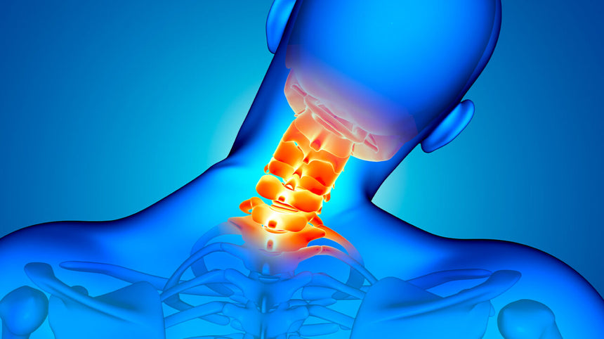 Sintomi della cervicale: identificare i segni premonitori