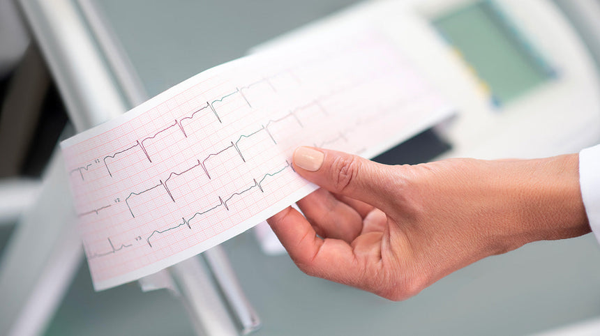 L'elettrocardiogramma (ECG): una guida completa